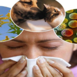 25 Best Homeopathic Medicines for Sneezing Allergy