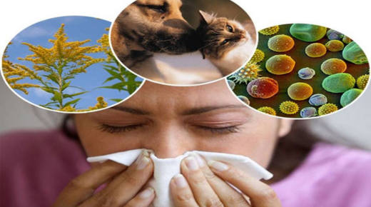 25 Best Homeopathic Medicines for Sneezing Allergy