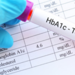 blood sugar test