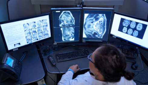 teleradiology services in India