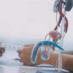 urologist in bangalore