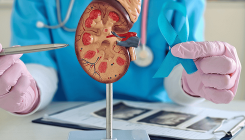 best nephrology hospital in bangalore