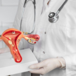 Best Nephrologist in bangalore