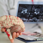 best neurology hospital in Hyderabad