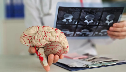 best neurology hospital in Hyderabad
