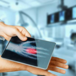 Digital x ray machine