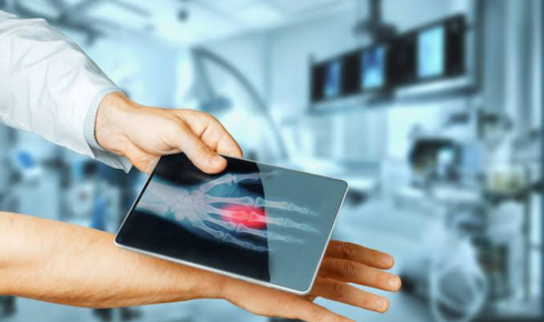 Digital x ray machine